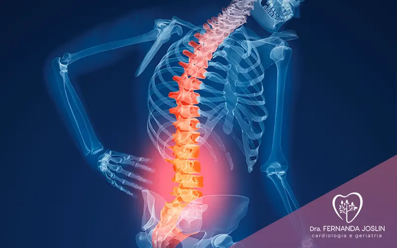O que é osteoporose e como evitar fraturas na terceira idade