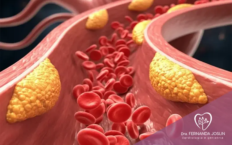Entenda o que é a Lipoproteína A e seus riscos para a saúde cardiovascular